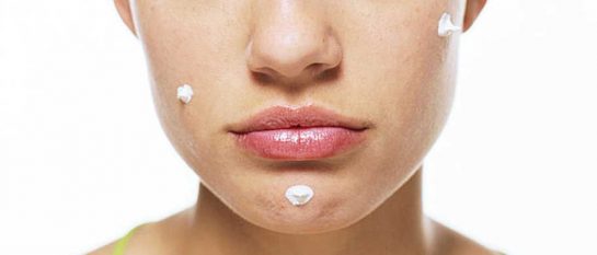 avoid pimples naturally